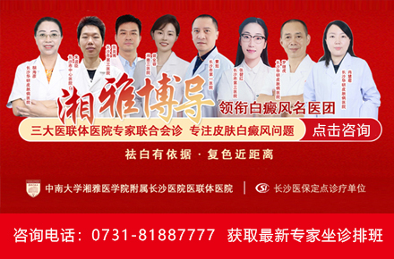 邵阳治疗白癜风医院